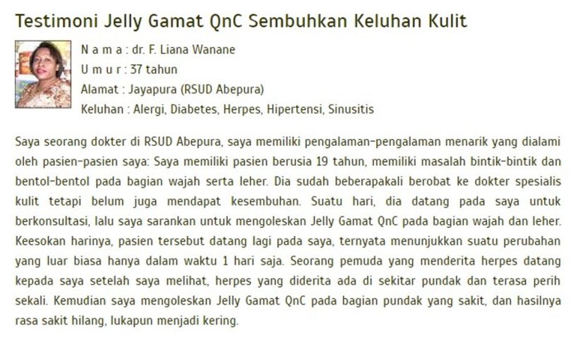 Cara Mengobati Herpes