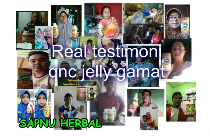 Cara Mengobati Herpes Agar Cepat Kerin